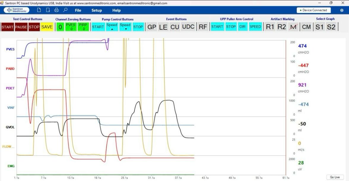 Santron diagnostic software interface preview